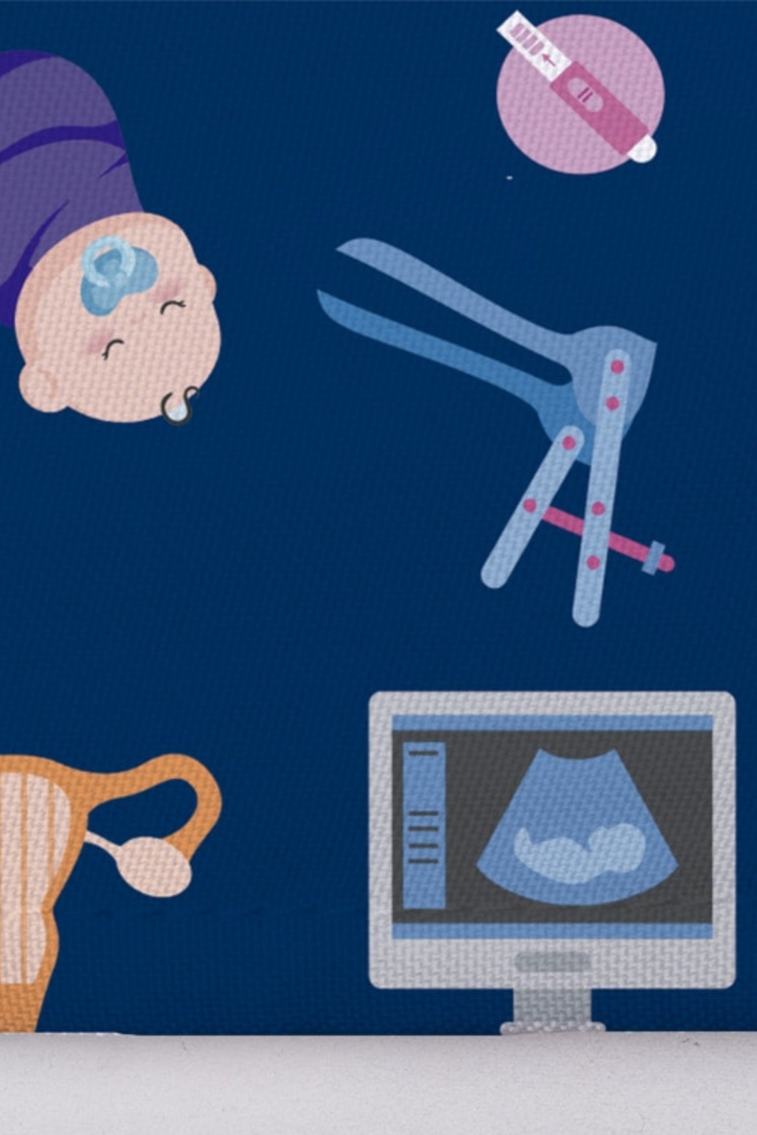 Ultrasound monitor showing fetal scan on Calot médical Aelin avec motifs uniques